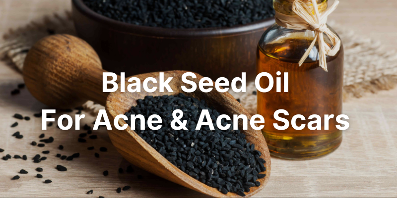 Black Seed Oil For Acne And Acne Scars