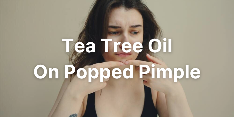 Can i use tea tree oil on popped pimple