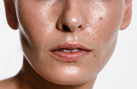 Is Glycerin Good For Dry Or Oily Skin?