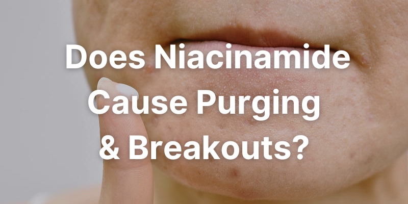 Does Niacinamide Cause Purging & Breakouts?